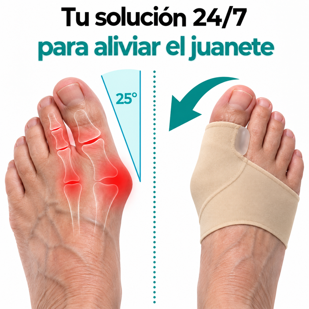 JuaneFix™ | Manga Correctora para Juanetes